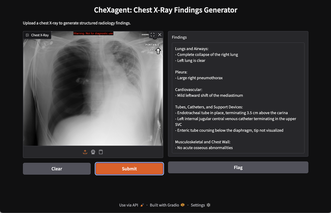 CheXagent Pneumothorax