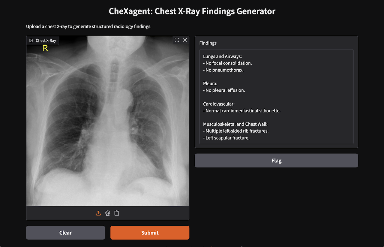 CheXagent Rib Fracture
